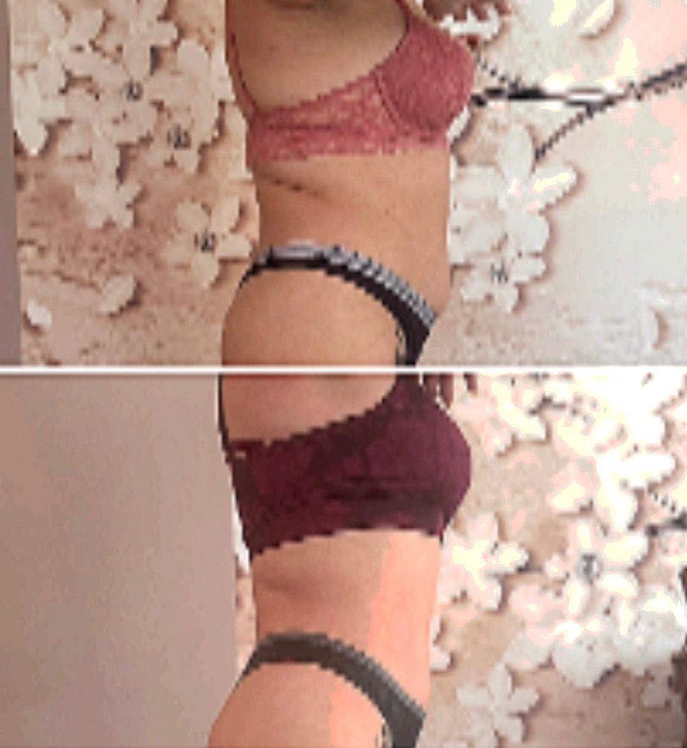 Antes y después